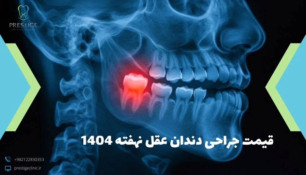 قیمت جراحی دندان عقل نهفته 1404