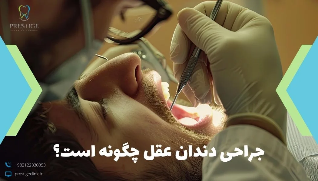 مراحل جراحی دندان چگونه است