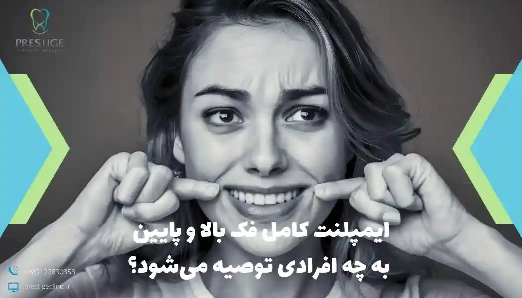 ایمپلنت کامل فک بالا و فک پایین به چه افرادی توصیه میشود؟