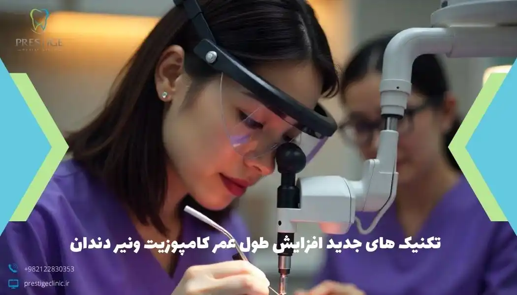 تکنیک های جدید افزایش طول عمر کامپوزیت ونیر دندان
