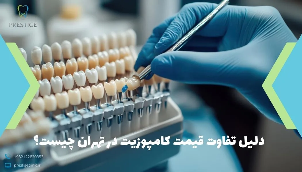 دلیل تفاوت قیمت کامپوزیت در تهران چیست؟