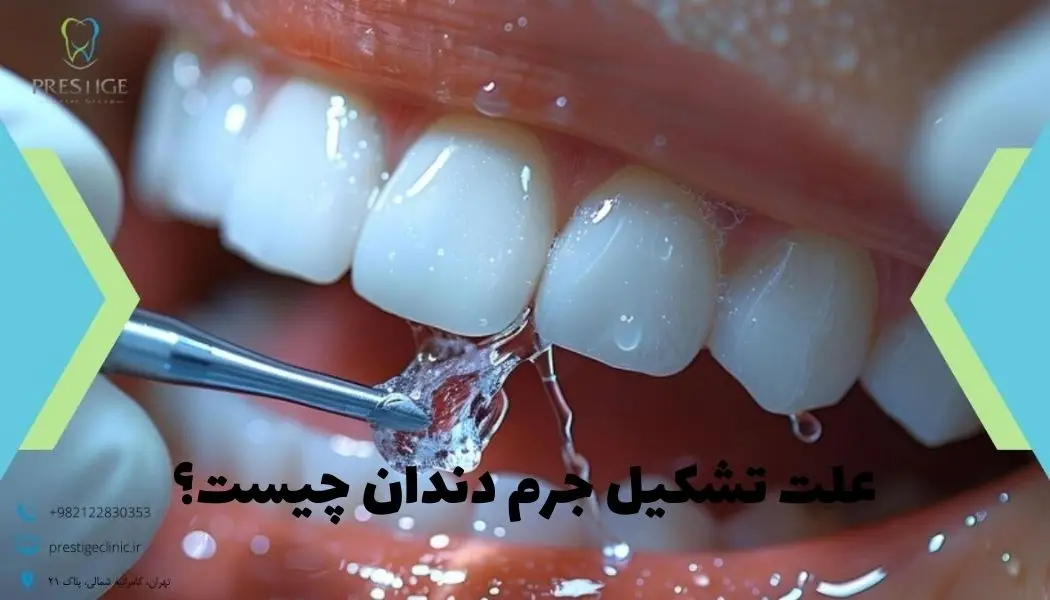 علت تشکیل جرم دندان چیست؟