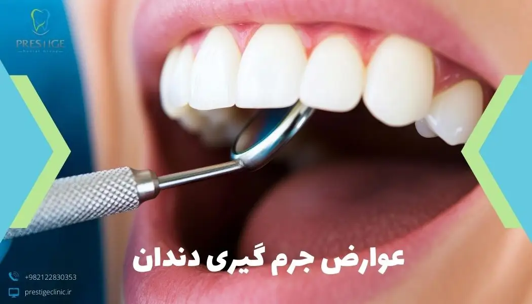 عوارض جرم گیری دندان