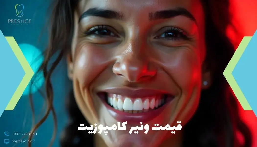 قیمت ونیر کامپوزیت
