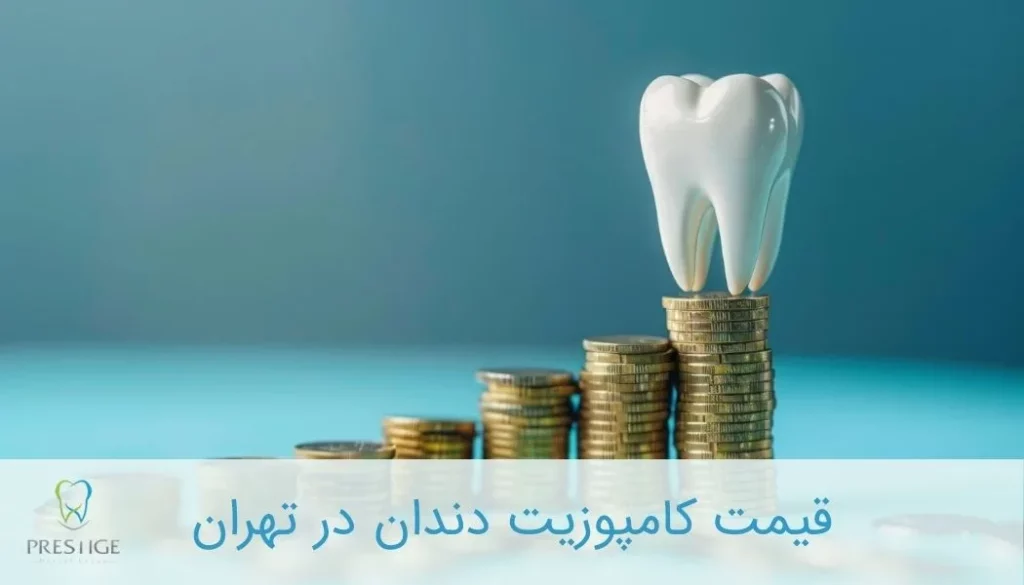 قیمت کامپوزیت دندان در تهران
