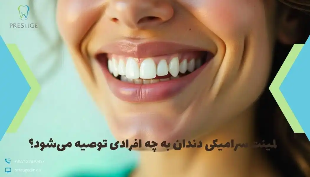 لمینت سرامیکی دندان به چه افرادی توصیه می‌شود؟