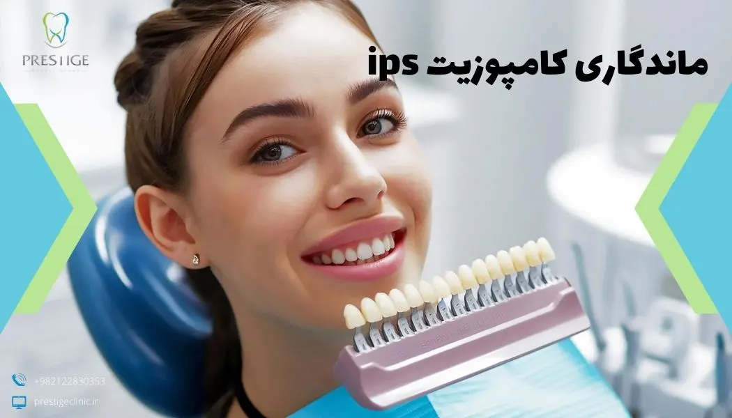 ماندگاری کامپوزیت ips چقدر است