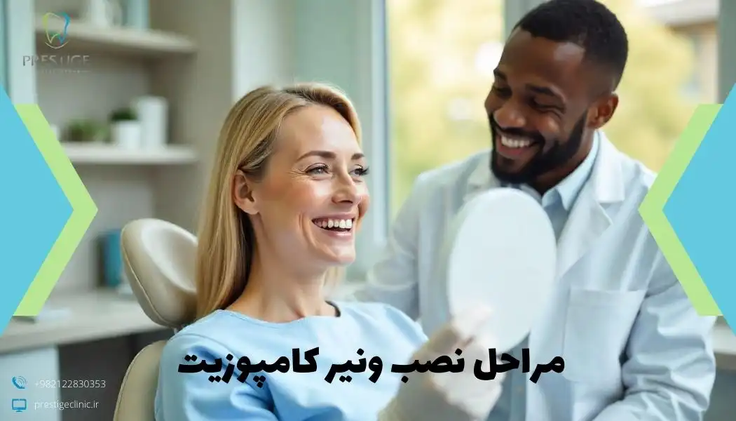 مراحل نصب ونیر کامپوزیت