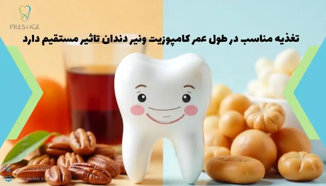 نقش تغذیه مناسب در طول عمر کامپوزیت ونیر دندان