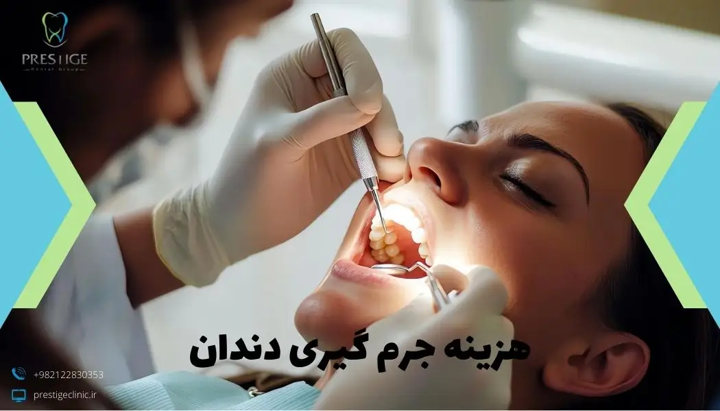 هزینه جرم گیری دندان