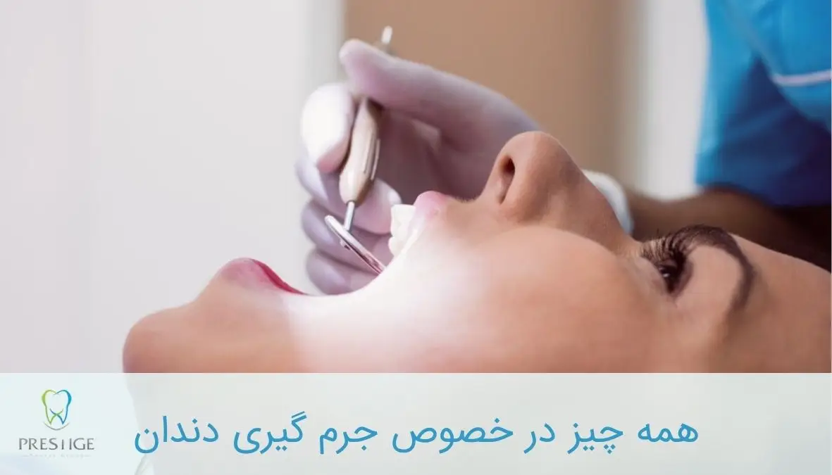 جرم گیری دندان