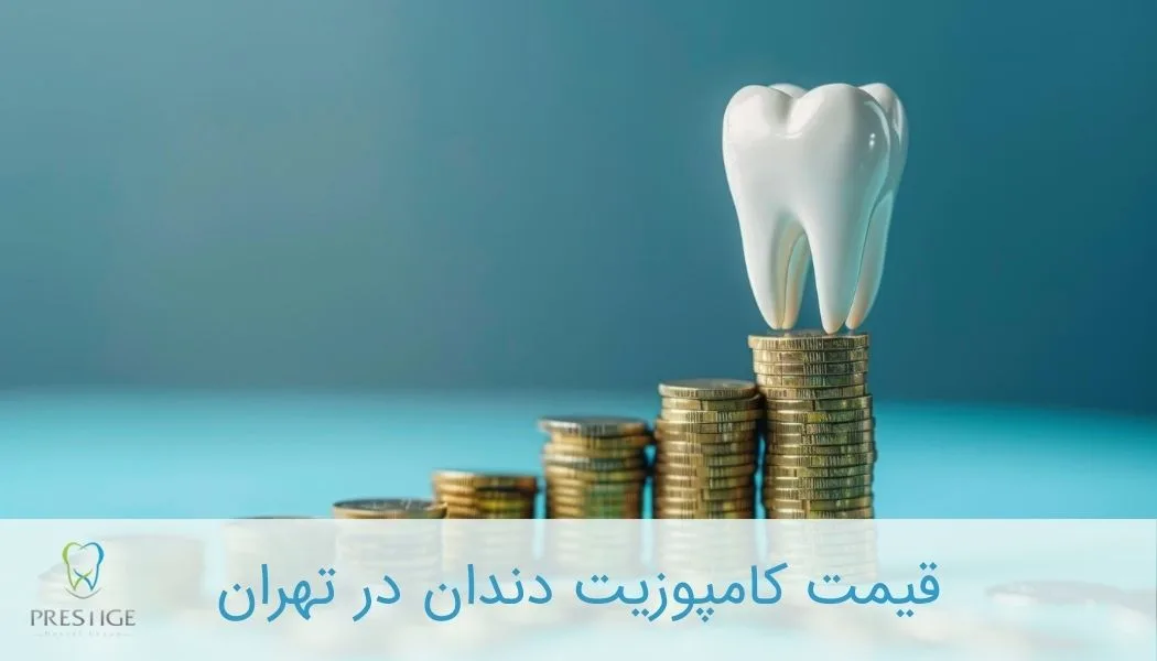 قیمت کامپوزیت دندان در تهران
