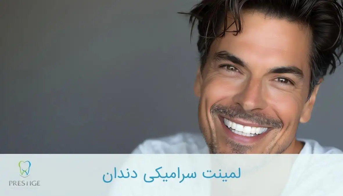 لمینت سرامیکی دندان