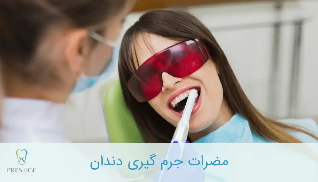 مضرات جرم گیری دندان
