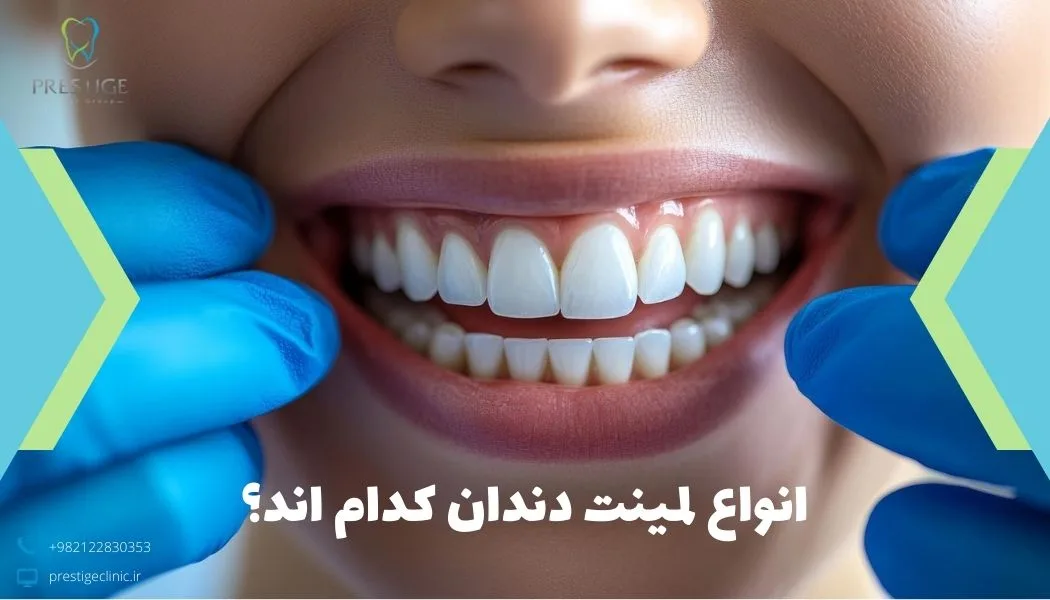 انواع لمینت دندان کدام اند؟