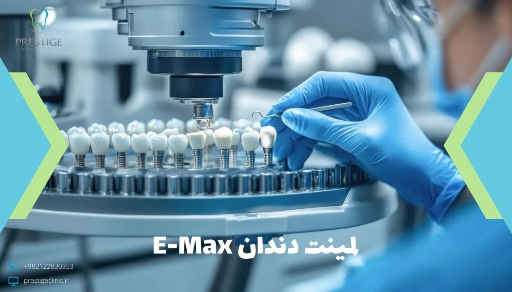 لمینت دندان E-Max