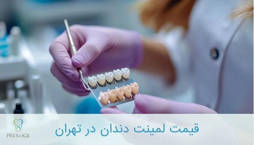 قیمت لمینت دندان در تهران