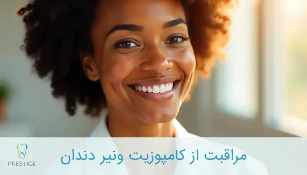 مراقبت از کامپوزیت ونیر دندان
