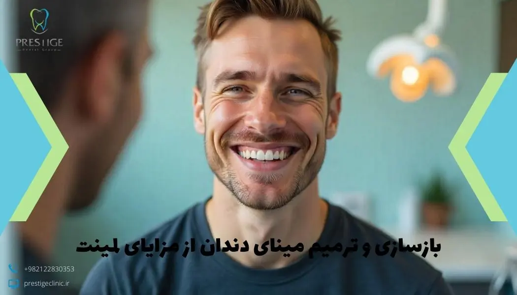 مزایای لمینت دندان
