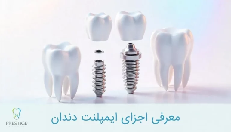 معرفی اجزای ایمپلنت دندان