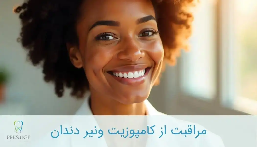 مراقبت از کامپوزیت ونیر دندان