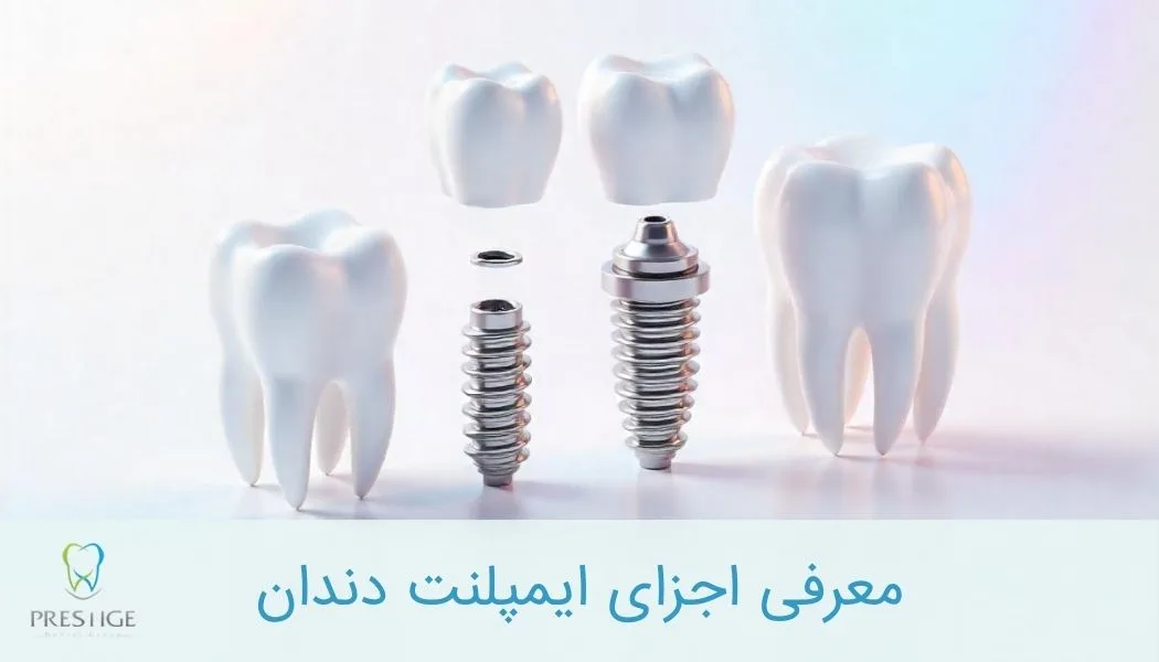 معرفی اجزای ایمپلنت دندان