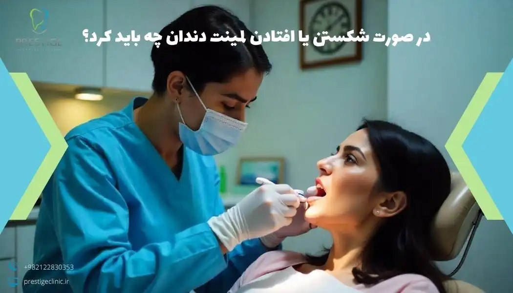 در صورت شکستن یا افتادن لمینت دندان چه باید کرد؟