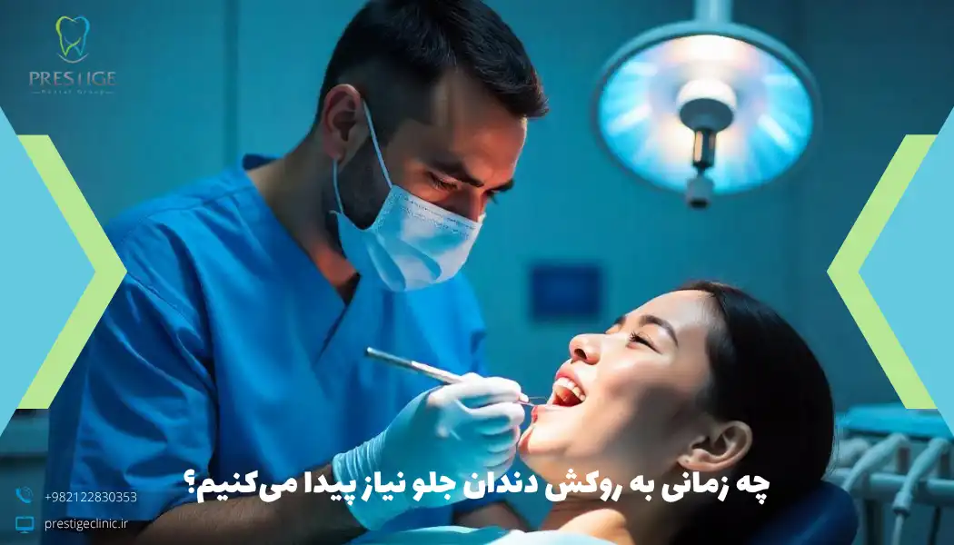 چه زمانی به روکش دندان جلو نیاز پیدا می‌کنیم؟