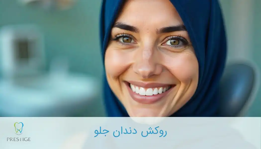 روکش دندان جلو
