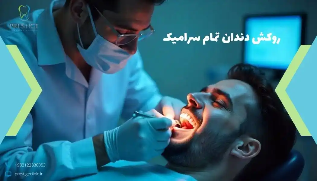 روکش‌ دندان تمام سرامیک