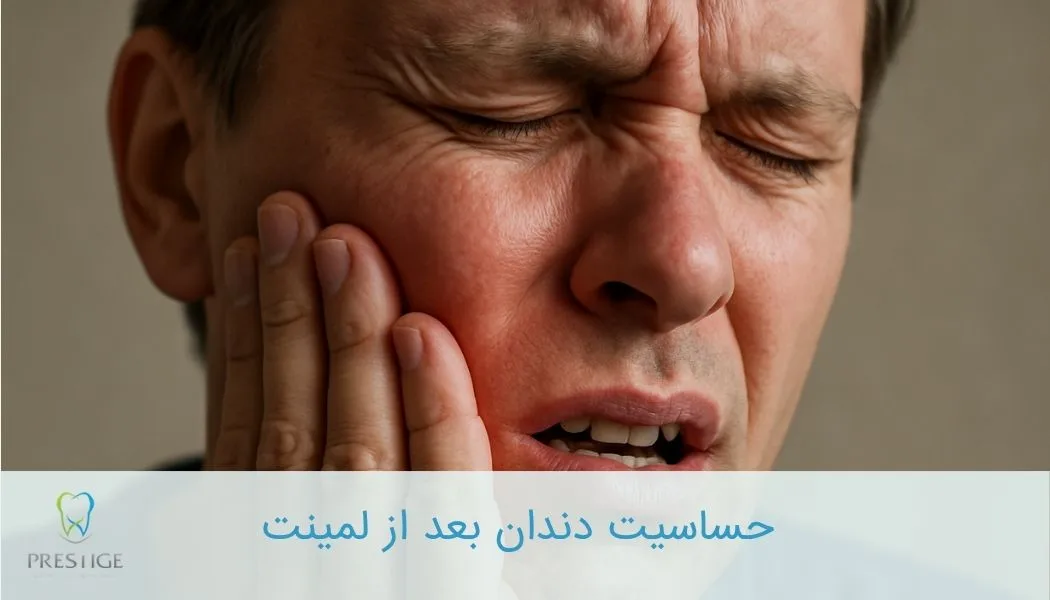 حساسیت دندان بعد از لمینت